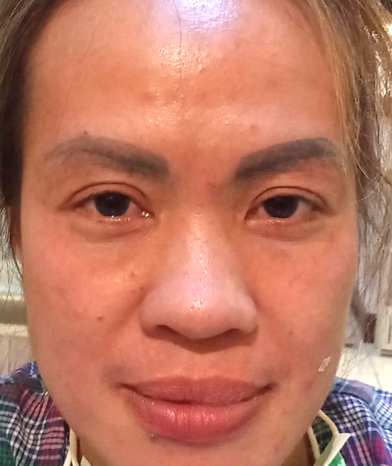 After Flek & Dark Spot