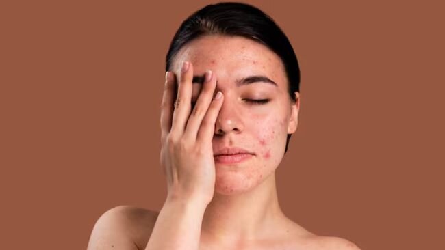Skincare Belum Efektif